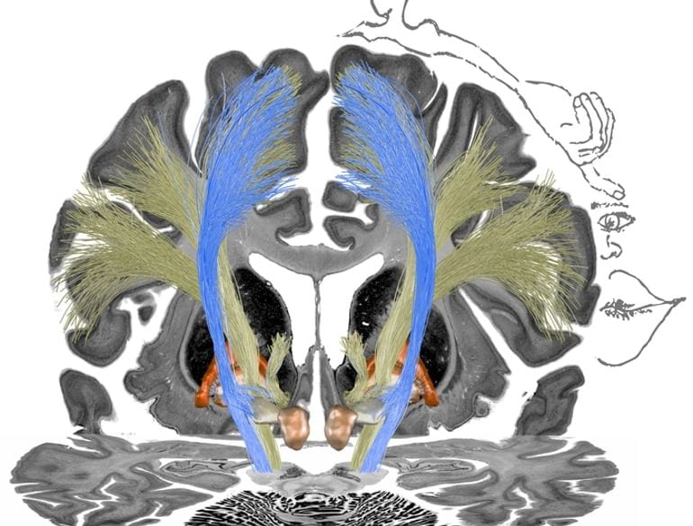 This shows a diagram of the brain