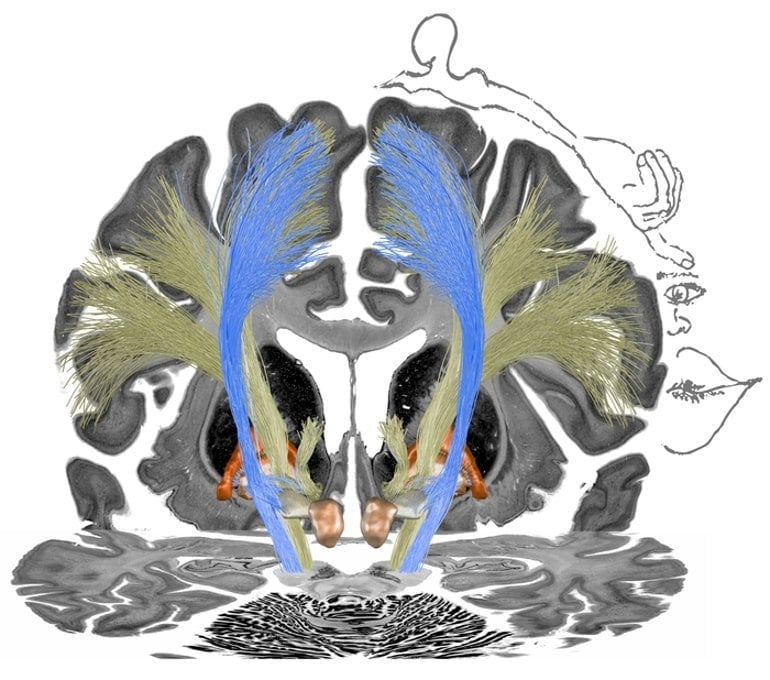 This shows a diagram of the brain