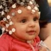 This shows a baby wearing an EEG net