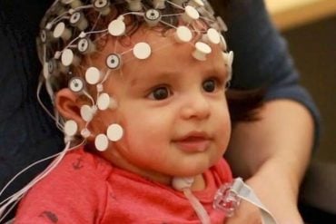 This shows a baby wearing an EEG net