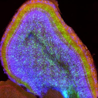 This shows a brain slice from a mouse