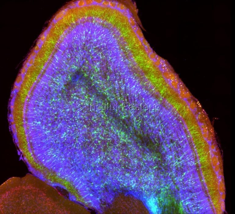 This shows a brain slice from a mouse