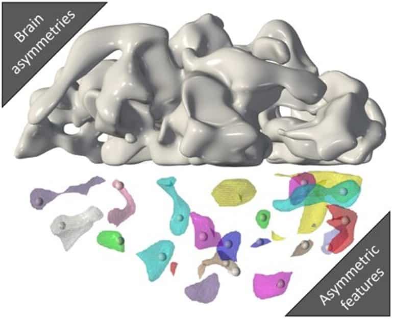 This shows the asymmetrical structures of the brain