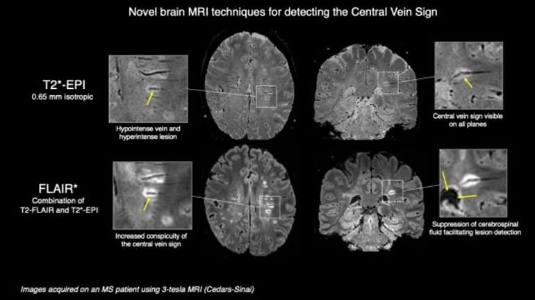 This shows brain scans from the study