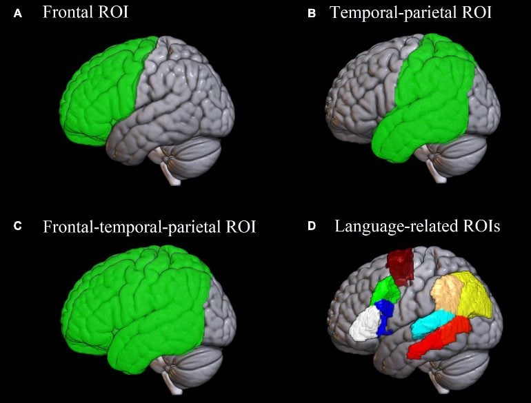 This shows the identified areas of the brain highlighted