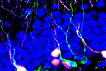 This shows new born neurons