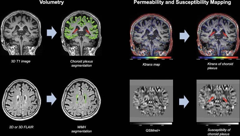 This shows brain scans from the study