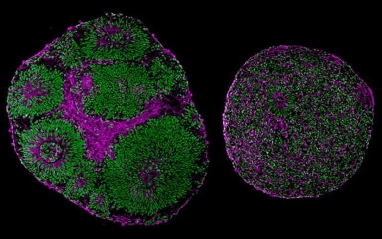 This shows two brain organoids