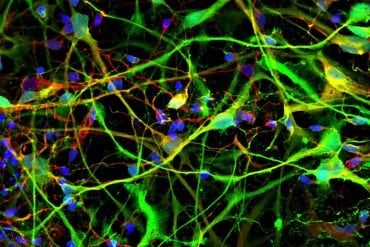 This shows stem cell derived neurons
