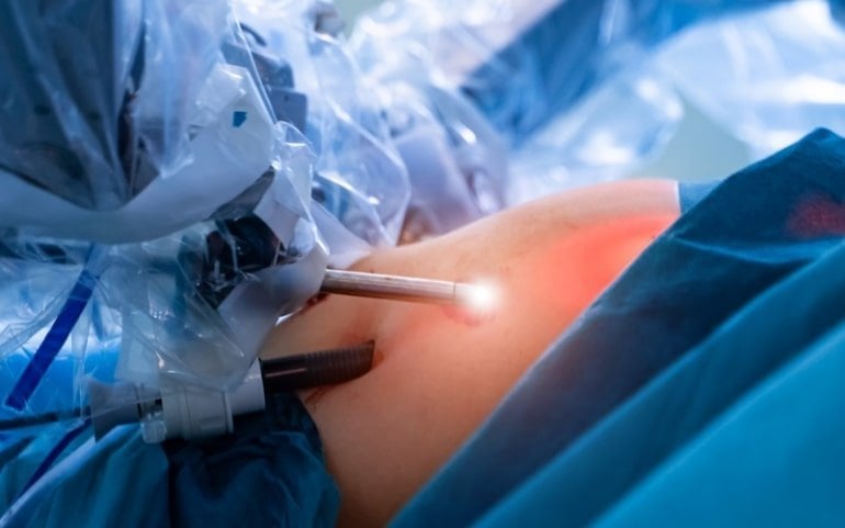 This shows a person undergoing robotic surgery