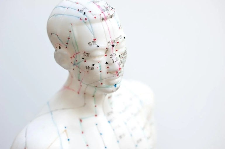 Can Acupuncture Reduce Headaches? - Neuroscience News