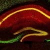 This shows the neurons in the mouse brain