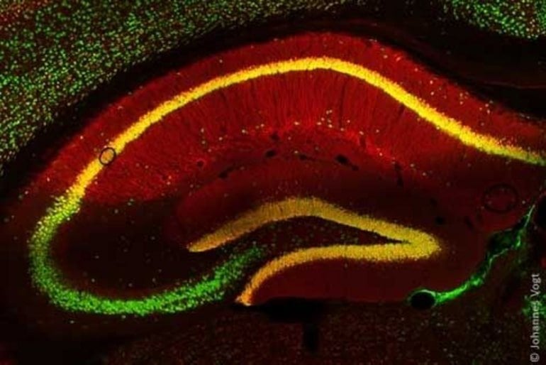 This shows neurons in a mouse brain