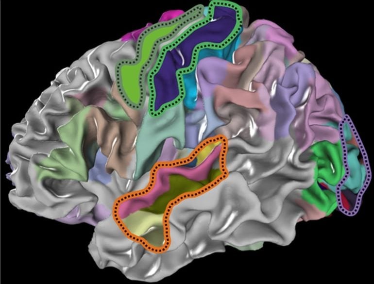This shows the brain with the different areas mapped