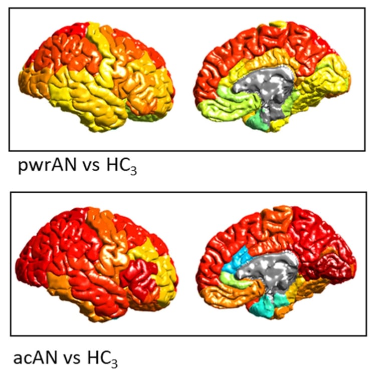 This shows brain scans from the study