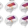 This shows brain images with temperature bars inside them