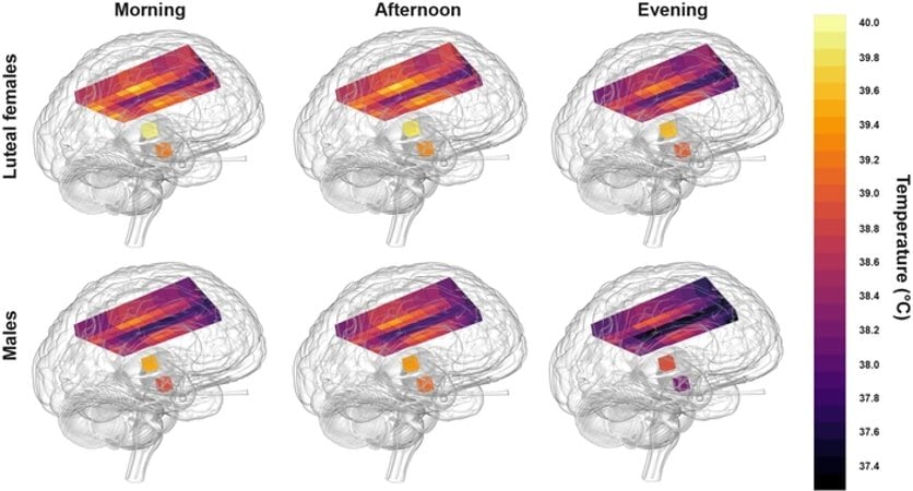 This shows brain images with temperature bars inside them