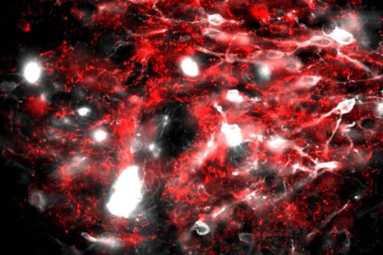 This shows neurons in the postrema