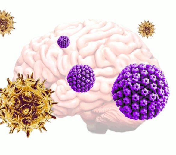This shows a brain surrounded by the different herpesviruses