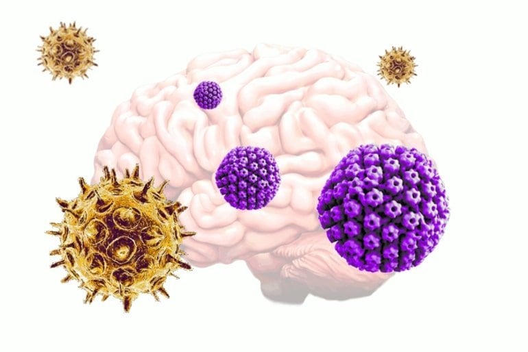 This shows a brain surrounded by the different herpesviruses