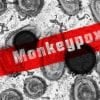 This shows the monkeypox virus