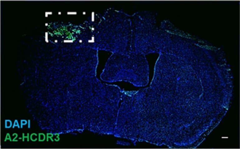 This shows damaged brain tissue