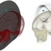This shows the images created by ultasound