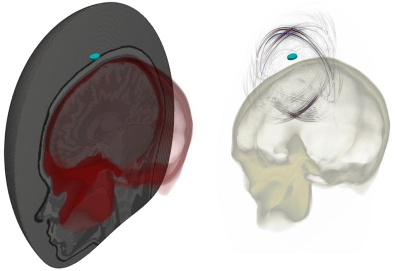 This shows the images created by ultasound