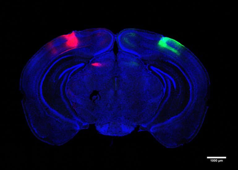 This shows the visual cortex in a brain slice