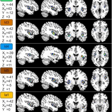 This shows the new layers mapped on brain scans
