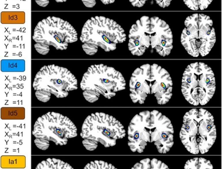 This shows the new layers mapped on brain scans