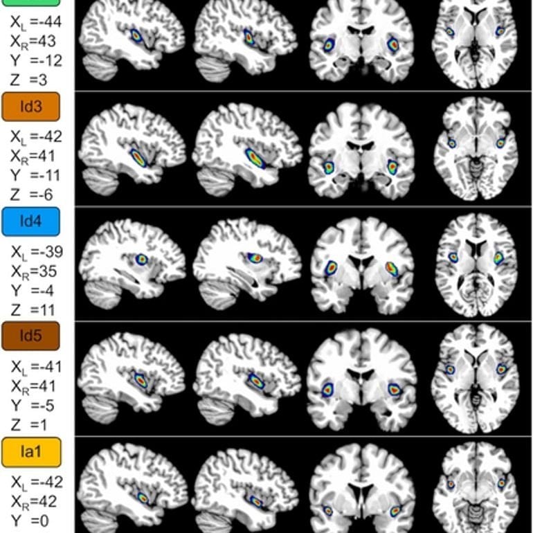 This shows the new layers mapped on brain scans