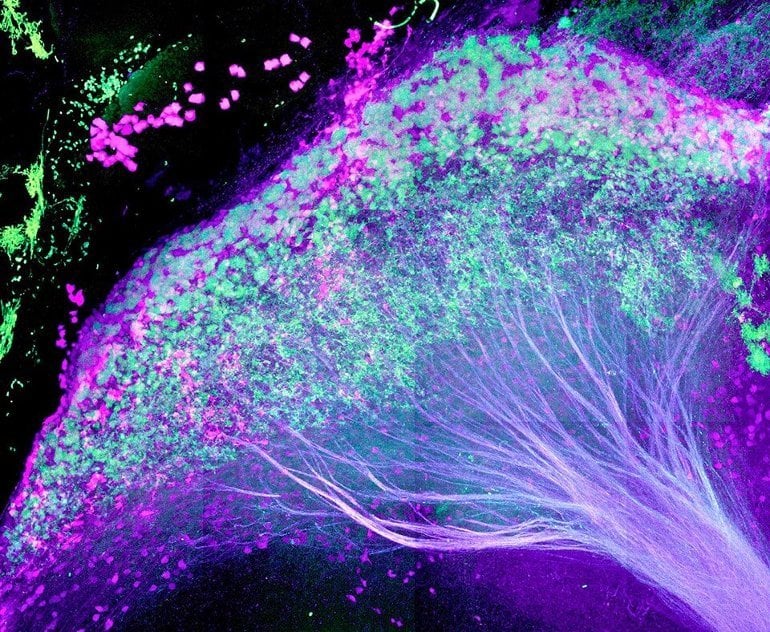 This shows neurons in the laternal habenula