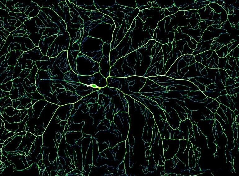 Pesquisadores visualizam as complexas ramificações do sistema nervoso