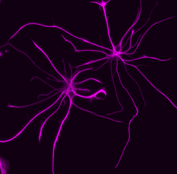 This shows astrocytes