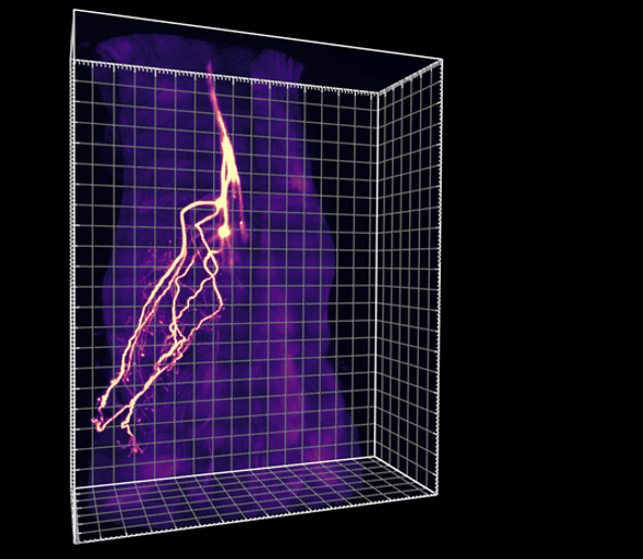 This shows sensory neurons