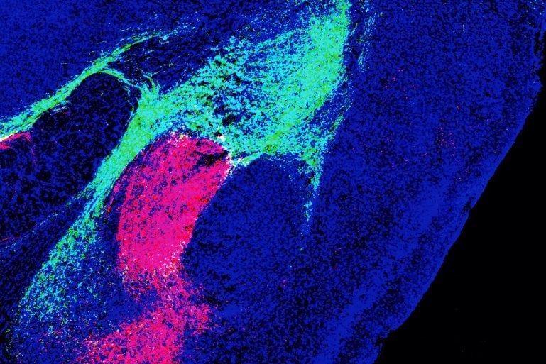 This shows neurons in the amygdala