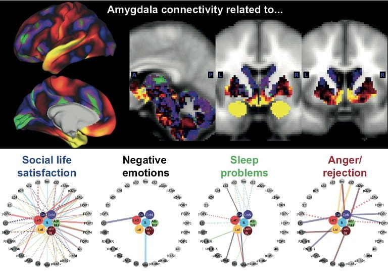 This shows brain scans from the study