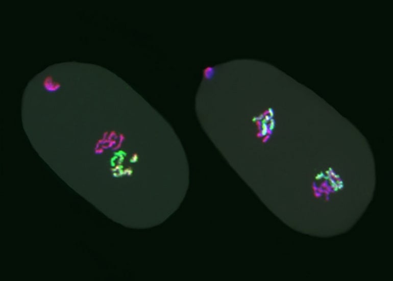 This shows the epigenetic markers