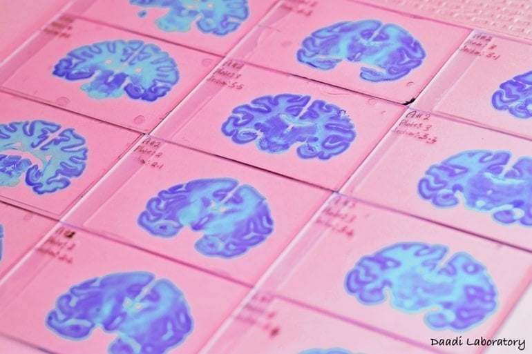 building-a-3d-brain-atlas-neuroscience-news