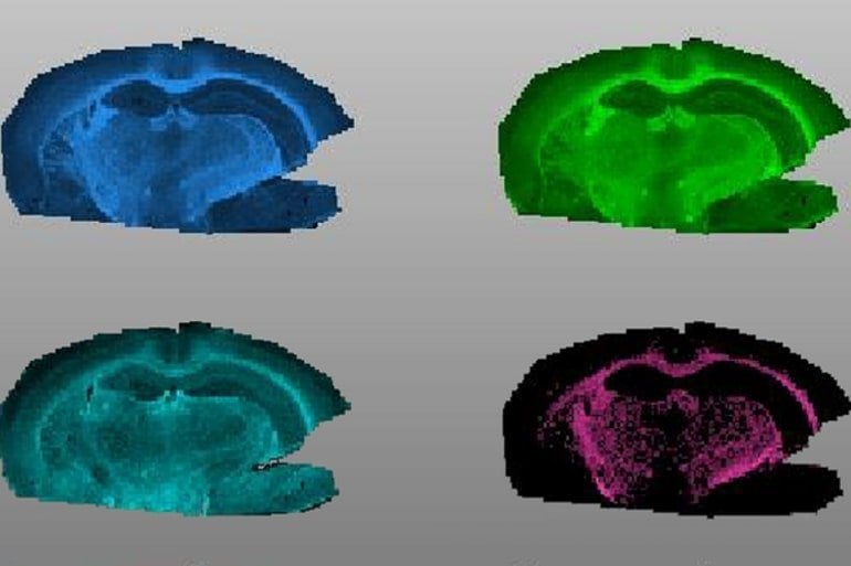 This shows images of the brain