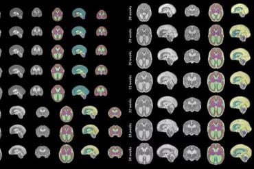 This shows brain scans from the study