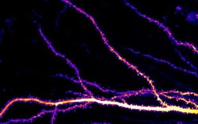 This shows a hippocampal neuron