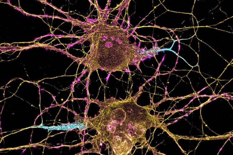 This shows neurons