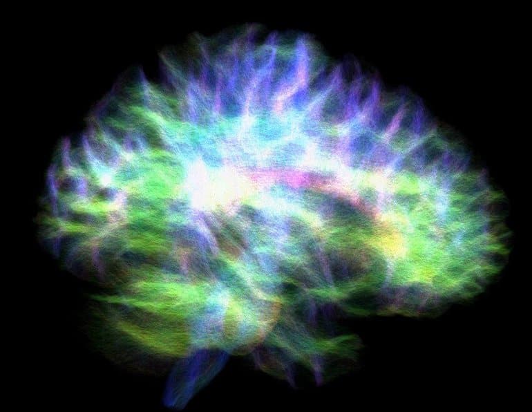 This shows a connectome map of the brain