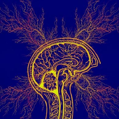 This shows a brain