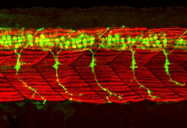 This shows motor neurons