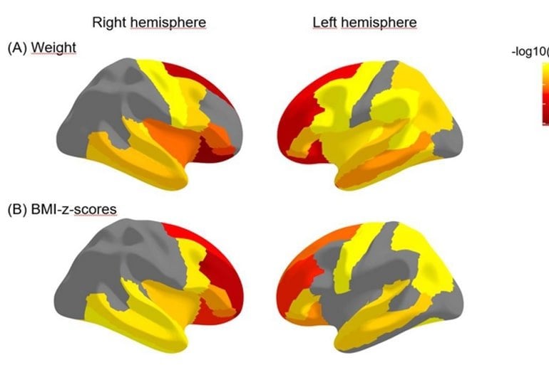 This shows brain maps from the study