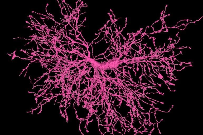 This shows oligodendrocyte precursor cells