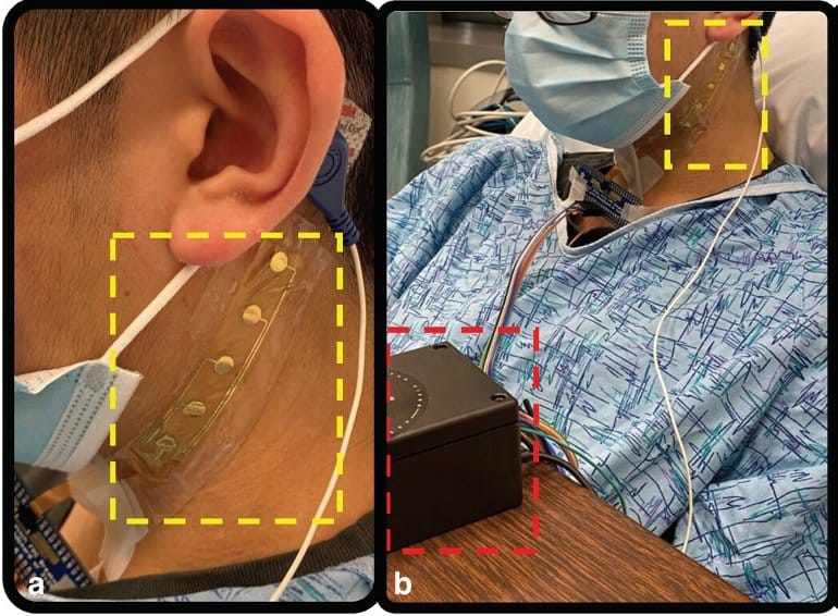 This shows the sensor on a patient's neck